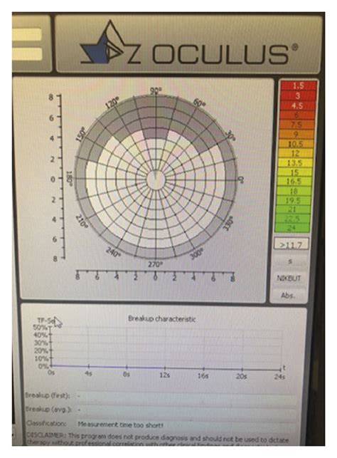 tear test results|reduced tear break up time.